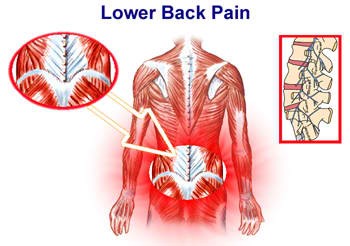 Sakit ng Likod o Low Back Pain: Ano ang Dapat Gawin at Lunas?