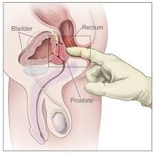 Prostatitis hol kell nézni